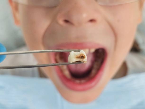 Best Emergency Treatment for Toothache in Brookside, AL